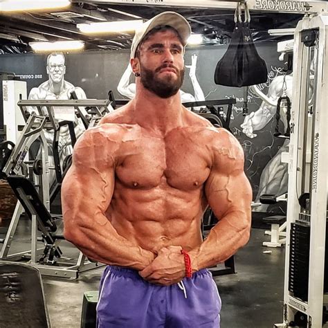 calum von moger injury update.